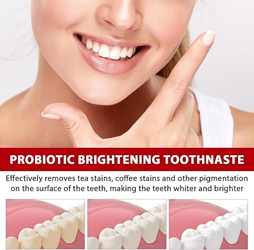 Sp-6 Ultra Whitening, Sp 6 Toothpaste, Ultra Whitening Toothpaste Sp - 6, Probiotic Brightening Toothpaste,Deep Cleaning Care Toothpaste,Fresh Breath120g (pack of 2)